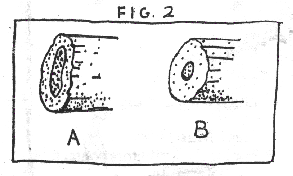 fig.2